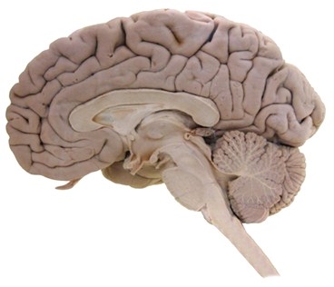 Brain_CrossSection