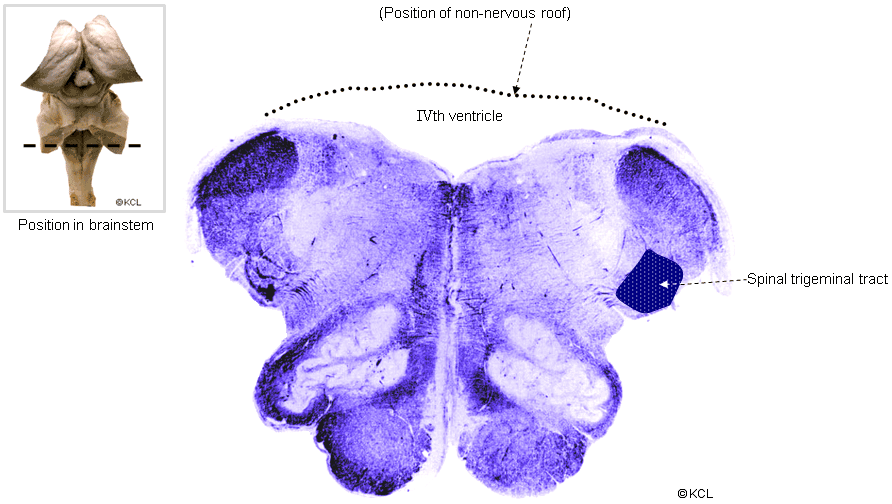 Section 6: upper open medulla > stained for myelin tracts