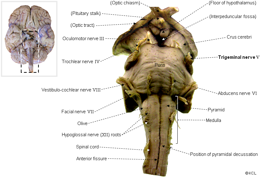 trigeminal nerve