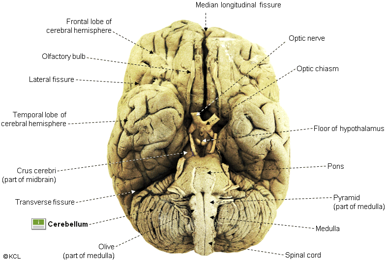 Brain > ventral view