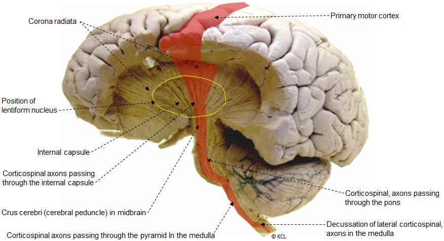 The internal capsule > Lateral view showing corticospinal pathway