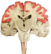 brain-coronal-section.png