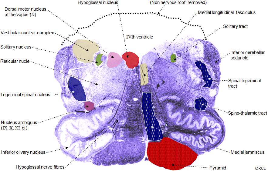 Section 5: Open medulla, level of inferior olive: all tracts and nuclei