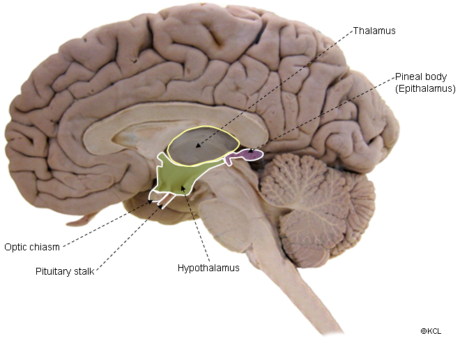 Thalamus - relation to other parts of the diencephalon