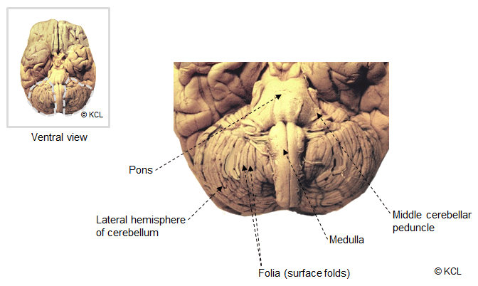 Cerebellum - Location and general features in situ - Ventral view