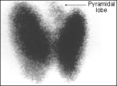 99m Tc Thyroid scan