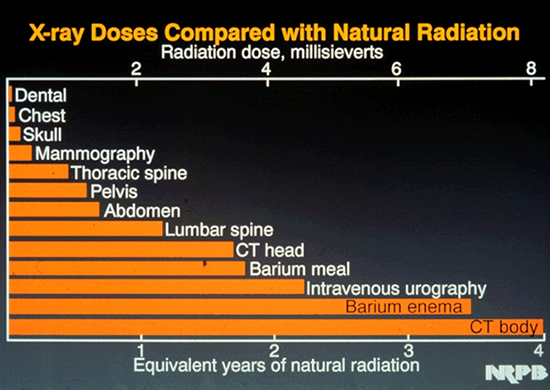 X-ray doses compared with natural radiation