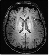 2.	Structural neuroimaging