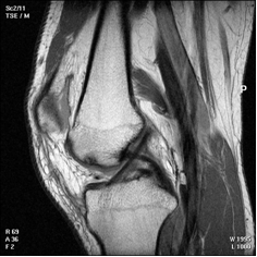 Musculoskeletal MRI