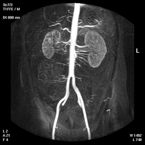 5.MR angiography