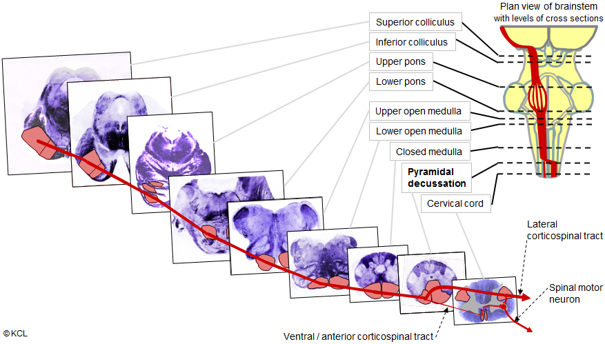 Lateral corticospinal tract