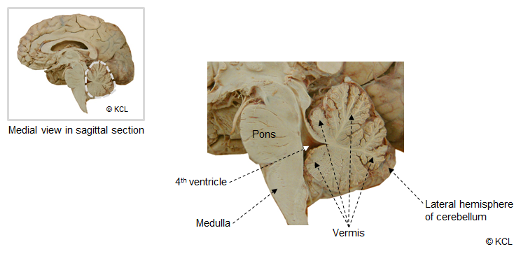 Cerebellum - Location and general features in situ - Medial view in sagittal section