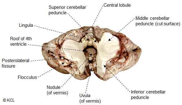 Antero-ventral view. The cerebellar peduncles have been cut through to remove the cerebellum from the brainstem