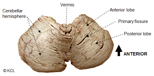 Cerebellum - External features visible when detached from the brainstem: Dorsal view