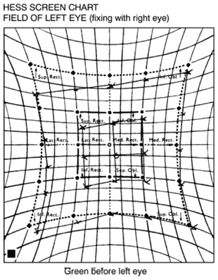 Hess chart