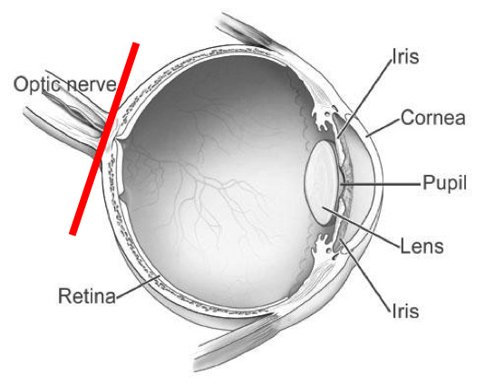 optic_nerve_diagram