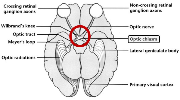 Visual pathway with optic chiasm highlighted