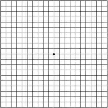 Amsler chart appearing as 'normal'
