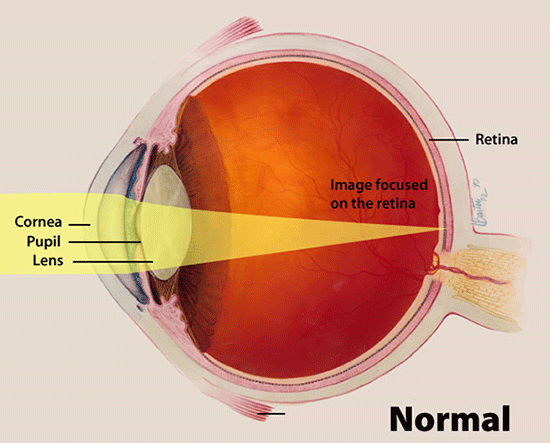 Normal lens