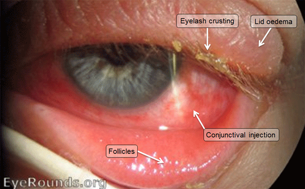 clinical signs