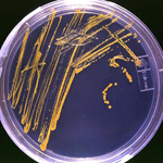 agar plate with colonies