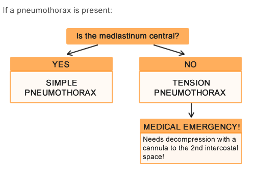 Pneumothorax