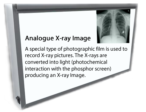 x-ray analogue