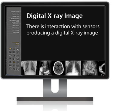 x-ray digital