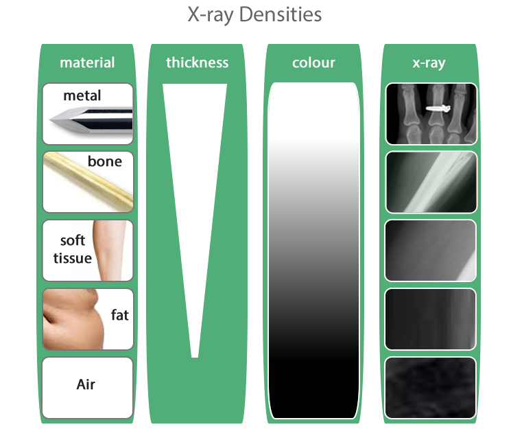 x-ray densities