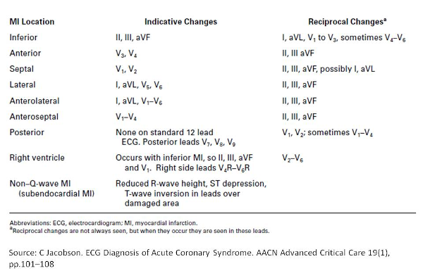 Table showing ECG diagnosis of acute coronary syndrome