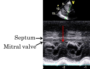 Echocardiogram image annotated - SAM