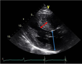 Echocardiogram image