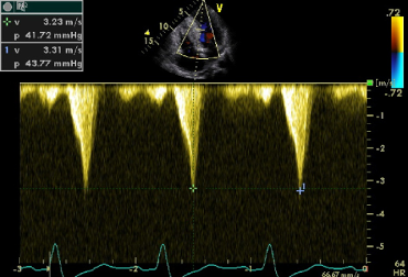 Echocardiogram image