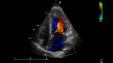 Echocardiogram image