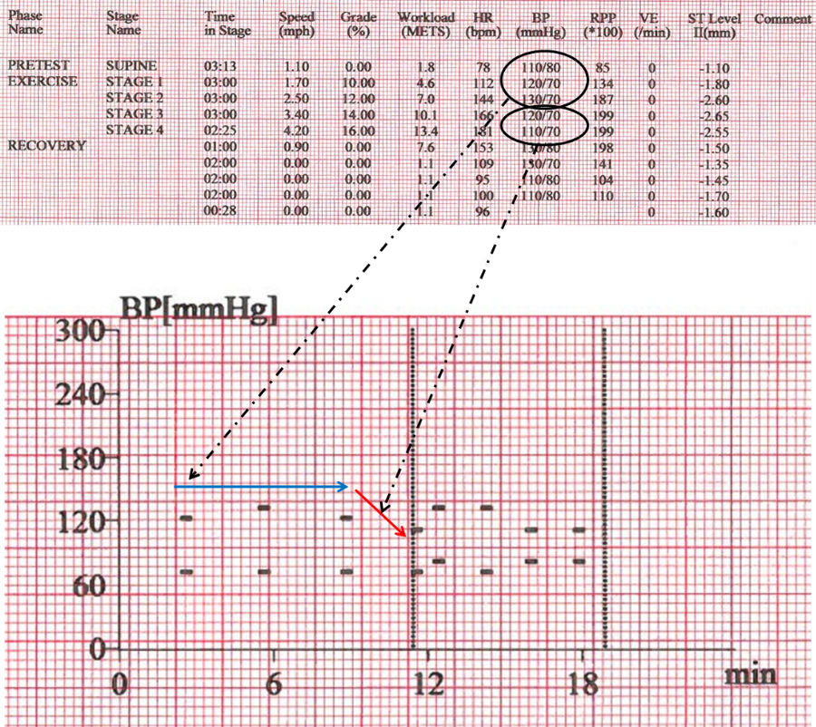 Exercise Test Results