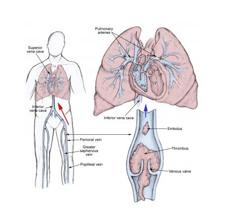 bronchovascular anatomy
